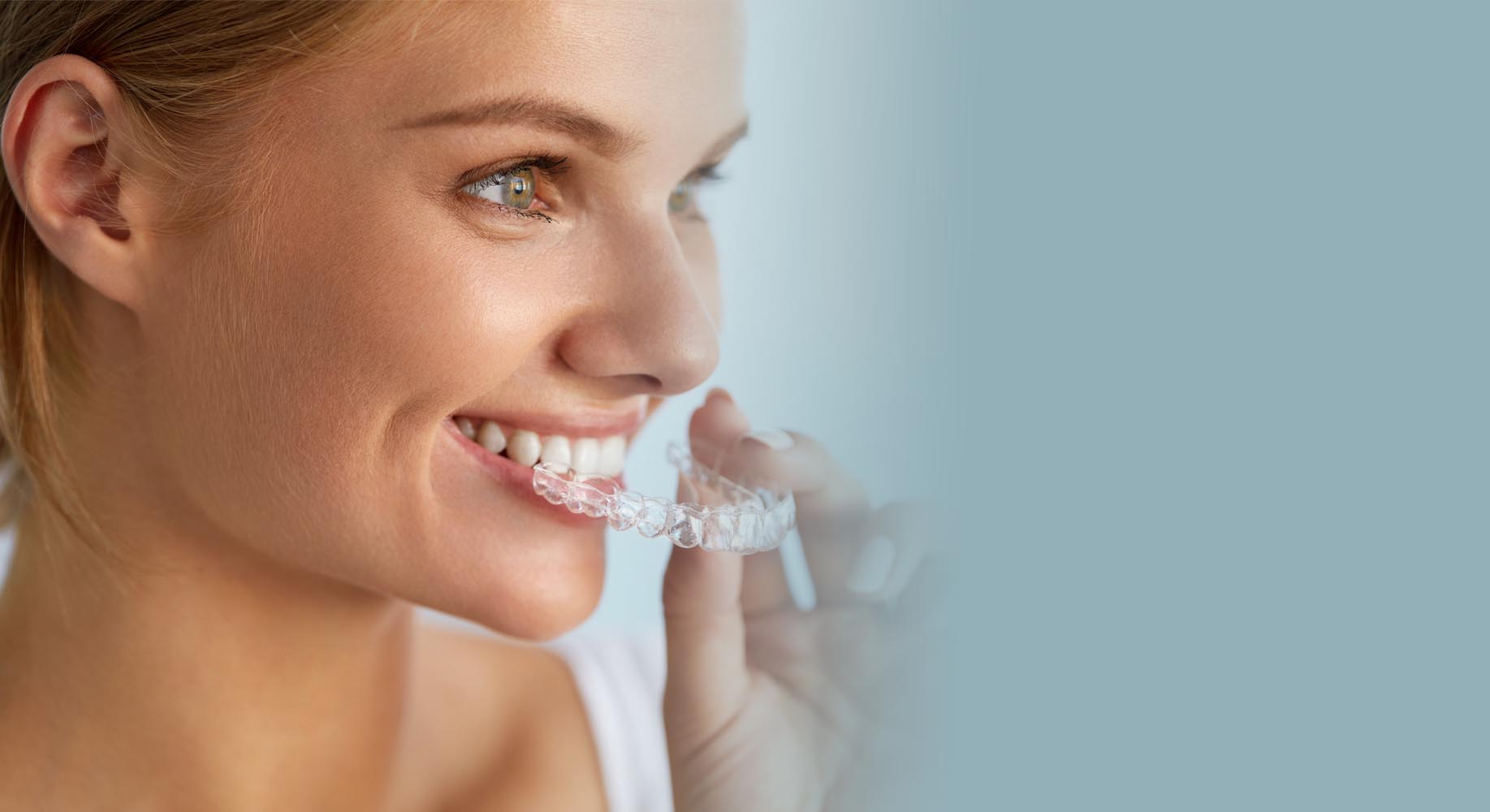 Invisalign Special