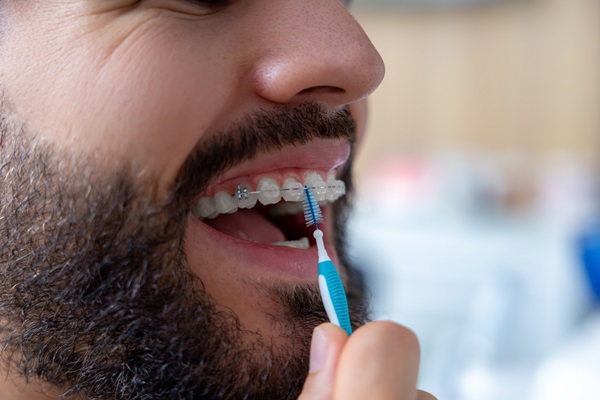 How To Keep Clear Braces From Yellowing