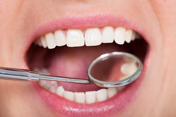 Dental Restoration: Learn About Fillings