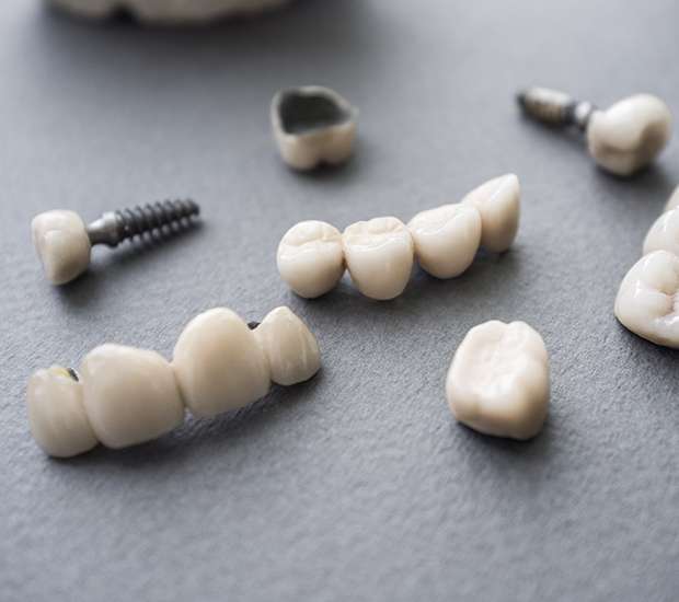 North Arlington The Difference Between Dental Implants and Mini Dental Implants