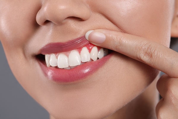 The Importance Of Periodontal Gum Disease Treatment