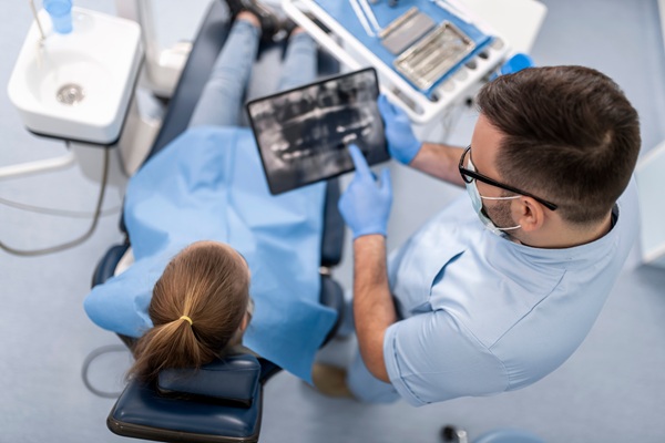 FAQs About Root Canal Treatment